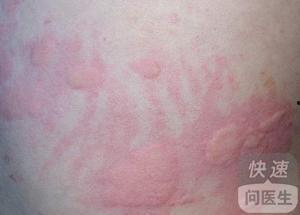 皮炎子吃瓜频道,揭秘娱乐圈幕后故事,带你领略明星真实生活